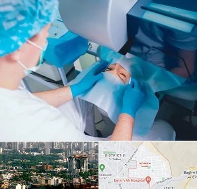 دکتر عمل لازک چشم در عظیمیه کرج