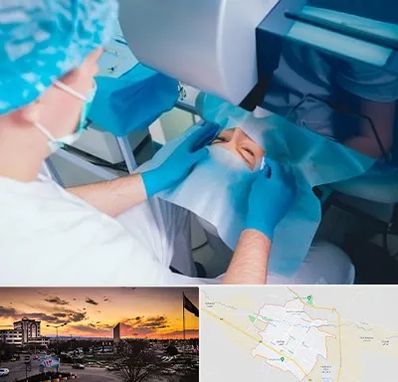 دکتر عمل لازک چشم در قوچان