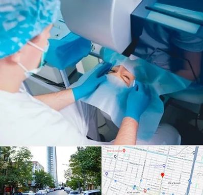 دکتر عمل لازک چشم در امامت مشهد