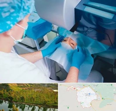 دکتر عمل لازک چشم در بهبهان