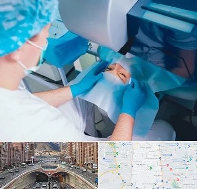 دکتر عمل لازک چشم در منطقه 10 تهران