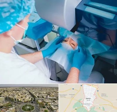 دکتر عمل لازک چشم در قزوین