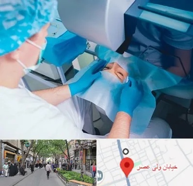 دکتر عمل لازک چشم در ولیعصر شهریار