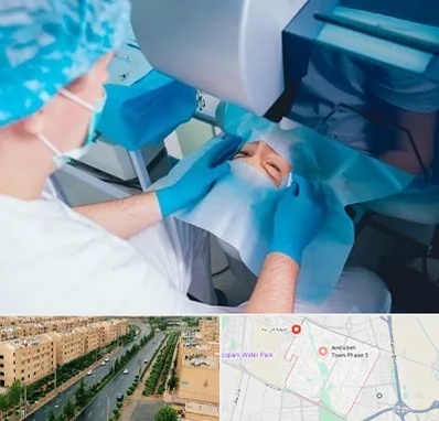 دکتر عمل لازک چشم در فاز سه اندیشه