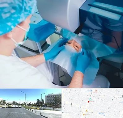 دکتر عمل لازک چشم در بلوار کلاهدوز مشهد