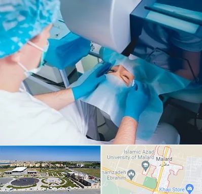 دکتر عمل لازک چشم در ملارد