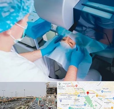 دکتر عمل لازک چشم در بلوار توس مشهد