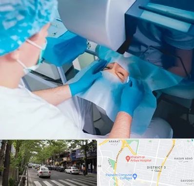 دکتر عمل لازک چشم در ظفر