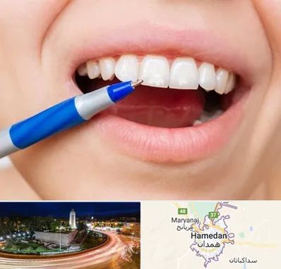 دندانسازی ارزان در همدان