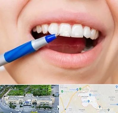 دندانسازی ارزان در نسیم شهر