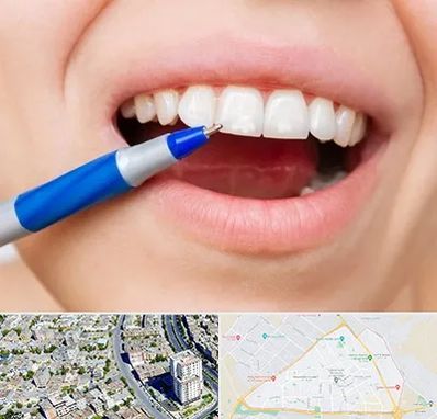 دندانسازی ارزان در قاسم آباد مشهد 