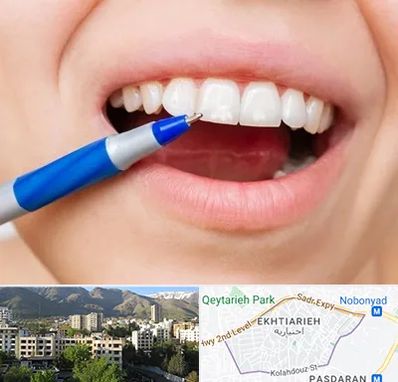 دندانسازی ارزان در اختیاریه 