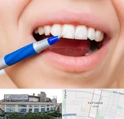 دندانسازی ارزان در یافت آباد