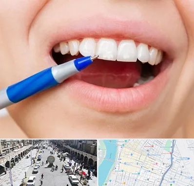 دندانسازی ارزان در نادری اهواز 