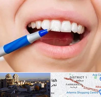 دندانسازی ارزان در فرمانیه 