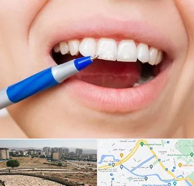 دندانسازی ارزان در کوی وحدت شیراز 