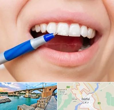 دندانسازی ارزان در دزفول