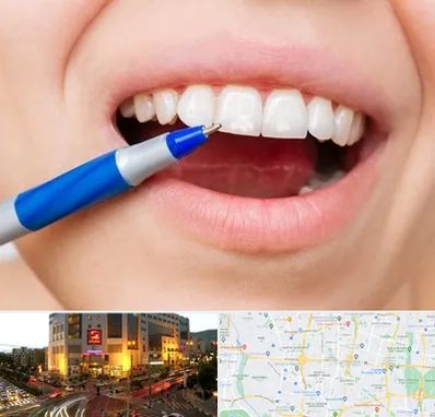 دندانسازی ارزان در جنت آباد تهران 