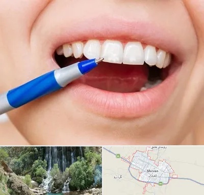دندانسازی ارزان در شیروان