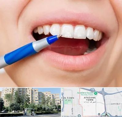 دندانسازی ارزان در آپادانا