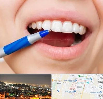 دندانسازی ارزان در مارلیک کرج 