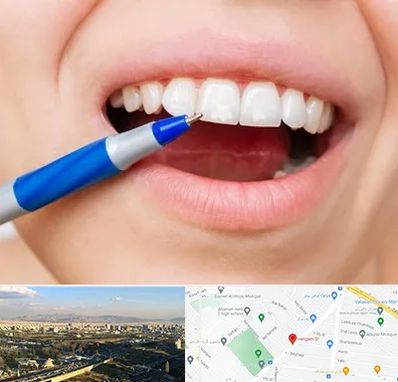 دندانسازی ارزان در هنگام 