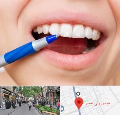 دندانسازی ارزان در ولیعصر شهریار