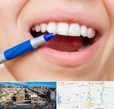 دندانسازی ارزان در شهرک راه آهن 