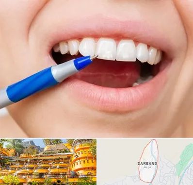 دندانسازی ارزان در دربند