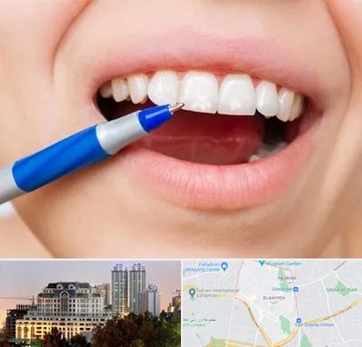 دندانسازی ارزان در فرشته 