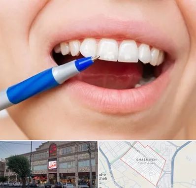 دندانسازی ارزان در قائمیه اسلامشهر