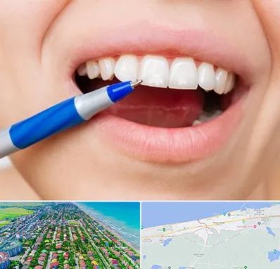 دندانسازی ارزان در فریدونکنار