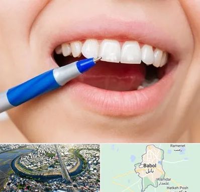 دندانسازی ارزان در بابل