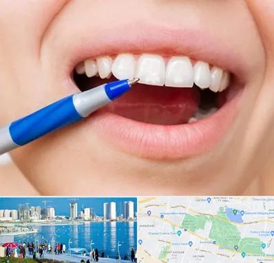 دندانسازی ارزان در چیتگر 