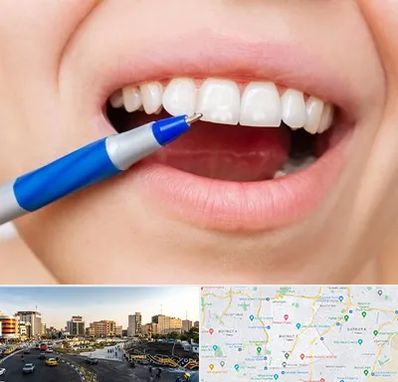 دندانسازی ارزان در منطقه 7 تهران 