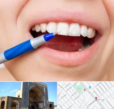 دندانسازی ارزان در مصلی مشهد