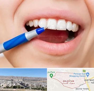 دندانسازی ارزان در شهرک گلستان شیراز 