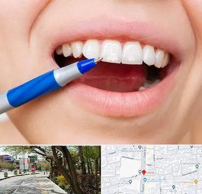 دندانسازی ارزان در خیابان توحید اصفهان 