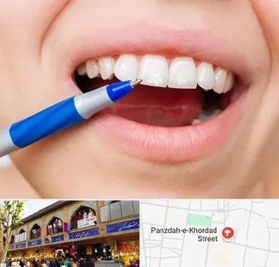 دندانسازی ارزان در 15 خرداد