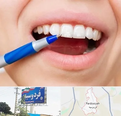 دندانسازی ارزان در فردوسیه شهریار