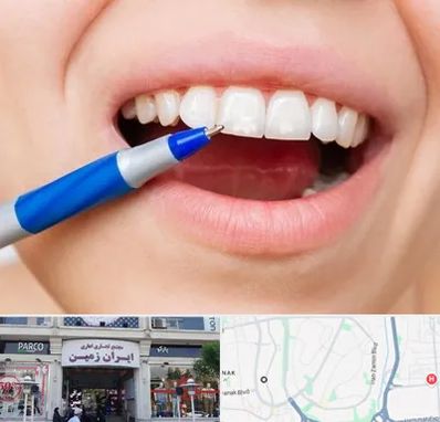 دندانسازی ارزان در ایران زمین
