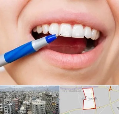 دندانسازی ارزان در شمس آباد تهران