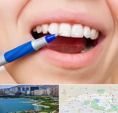 دندانسازی ارزان در منطقه 22 تهران 