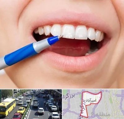 دندانسازی ارزان در امیرآباد