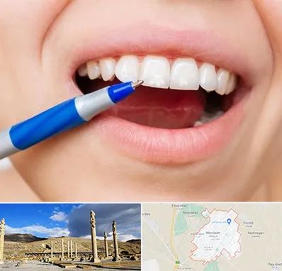 دندانسازی ارزان در مرودشت