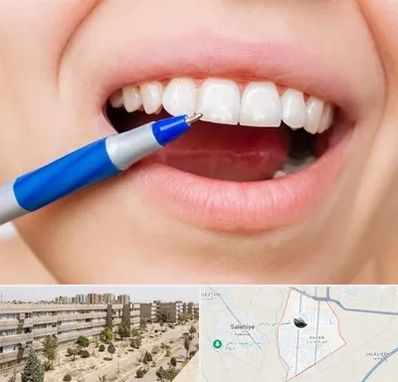 دندانسازی ارزان در واوان اسلامشهر