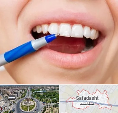 دندانسازی ارزان در صفادشت