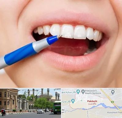 دندانسازی ارزان در پاکدشت