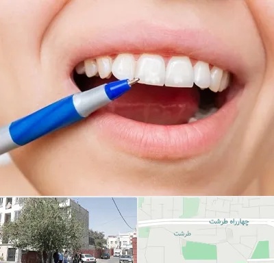 دندانسازی ارزان در طرشت