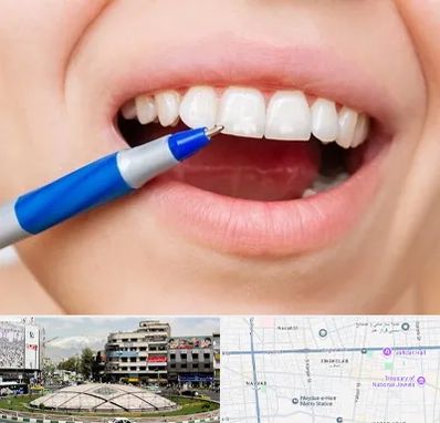 دندانسازی ارزان در مرکز تهران